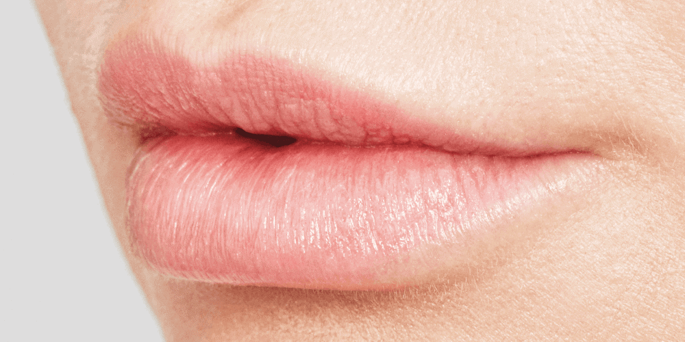 Lippen na lip fillers