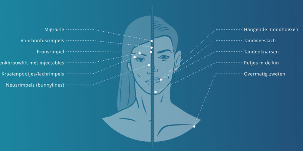 Botox indicaties