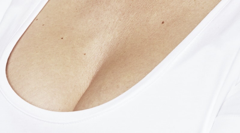 Skinboosters decolleté na