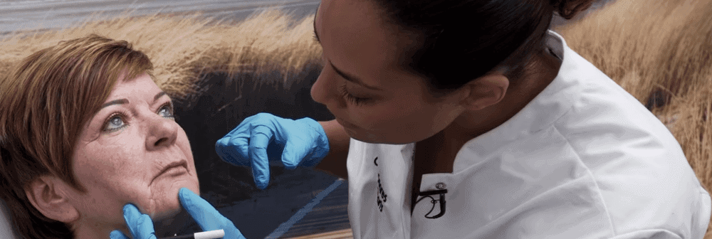 behandelingen - injectables - kaaklijn verstrakken