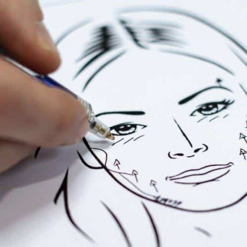 Behandelingen - facelift - S-lift