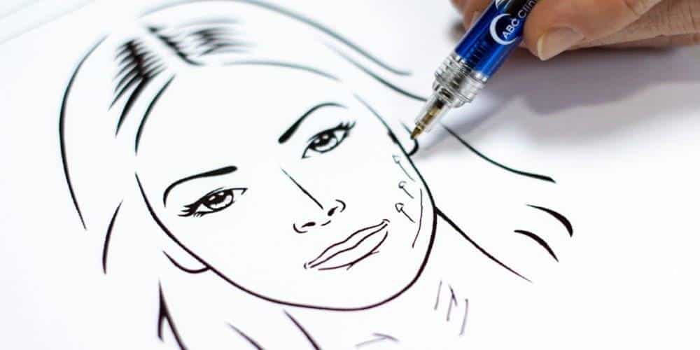 Behandelingen - facelift - hals-facelift