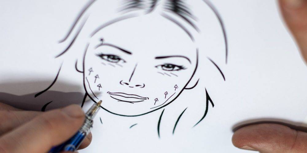Behandelingen - facelift - macs-lift - minilift, threadlift, draadlift