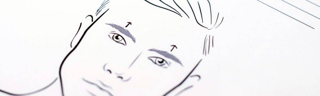 behandelingen - gezicht - facelift - wenkbrauwlift
