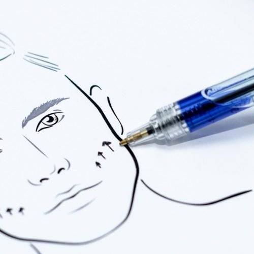 behandelingen - gezicht - facelift - minilift