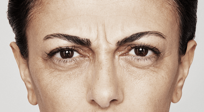 behandelingen - injectables - Botox-behandeling Amsterdam voor