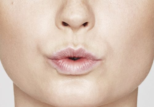 Lippen opvullen voor, lip fillers, volle lippen