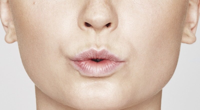 Lippen opvullen voor, lip fillers, volle lippen