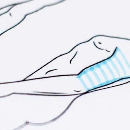 behandelingen - plastische chirurgie - Armlift