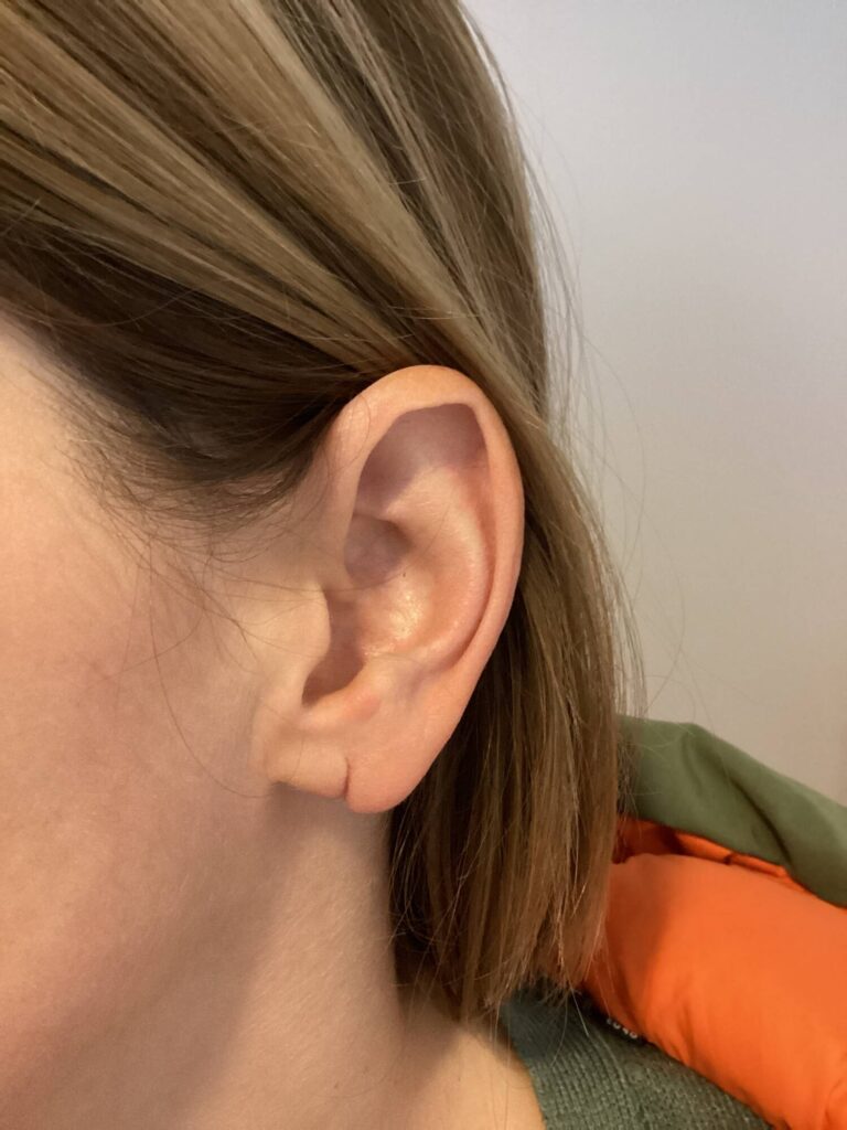 oorlelcorrectie voor