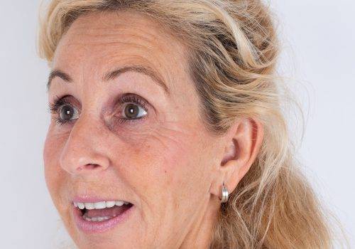 Behandeling van de voorhoofdsrimpels Patricia met Botox