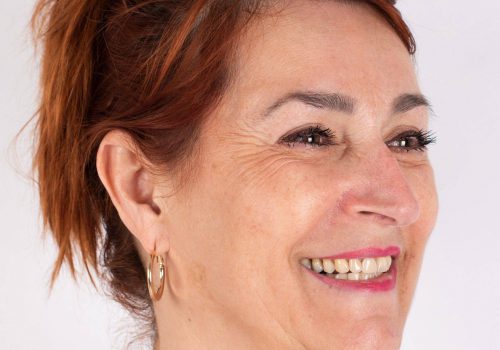 Lachrimpels Botox behandeling met Azzalure