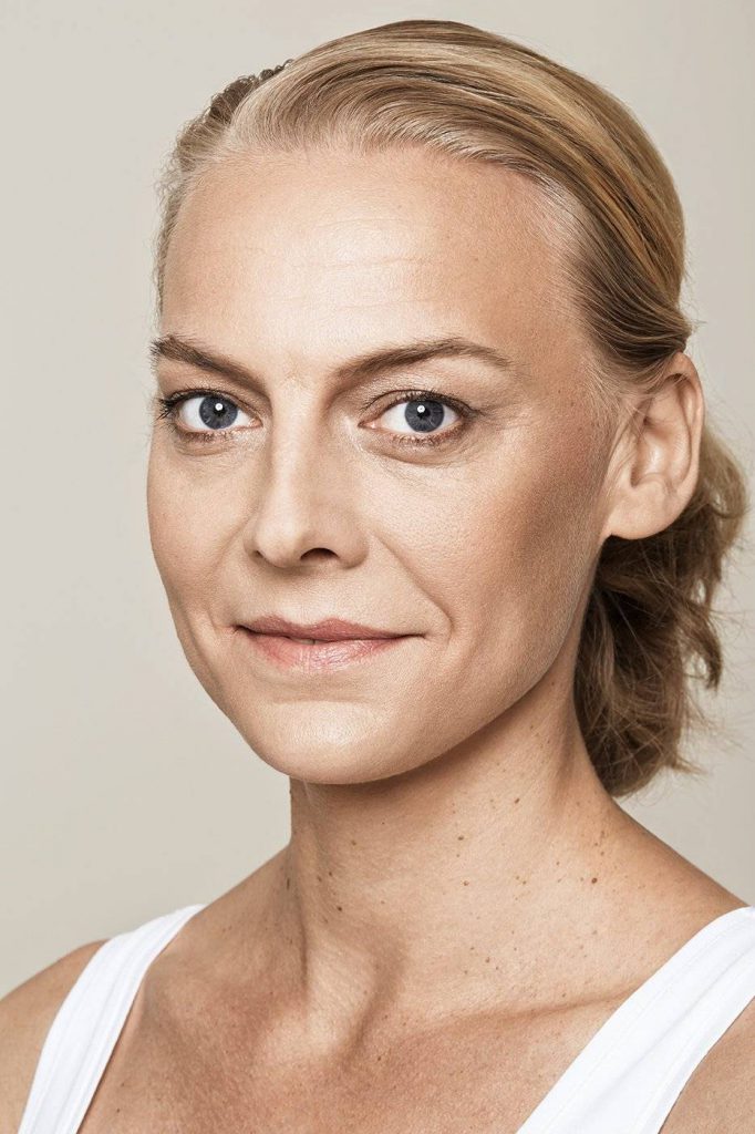 Traangoot opvullen met injectables, traandal
