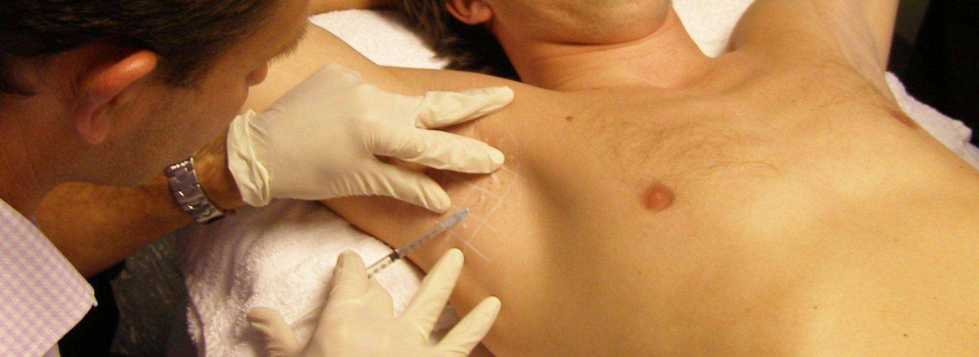Botox tegen overmatig zweten