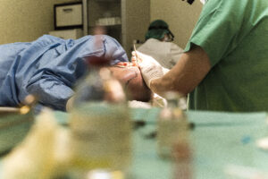 Haartransplantatie Arjan Benning - Extractie door arts
