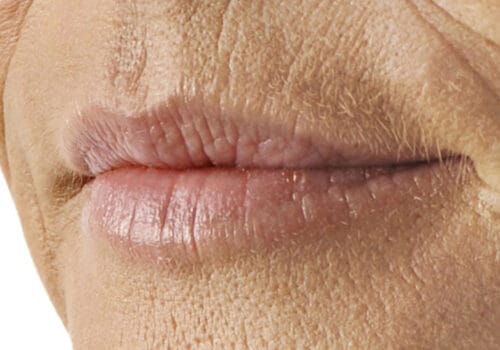 Lip smoothie voor foto - droge lippen