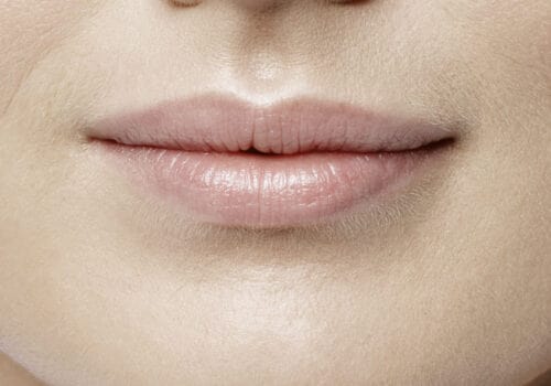 Lippen opvullen voor