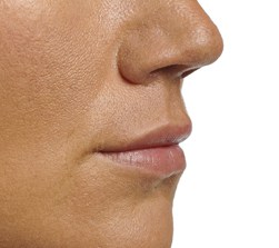 Volume in lip na - lippen opvullen - lip fillers - injectables