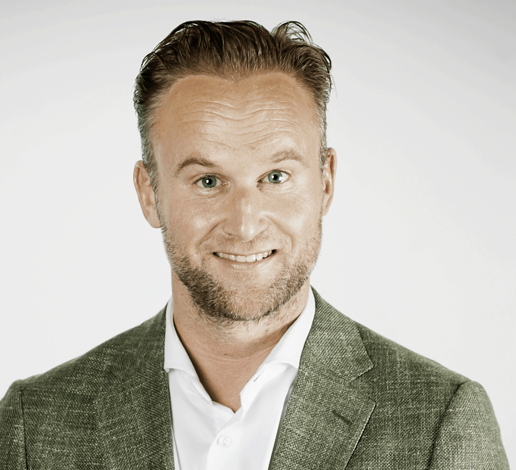 Jorn Kielman haartransplantatie