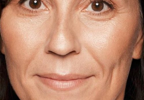 Vrouw wangen opvullen voor