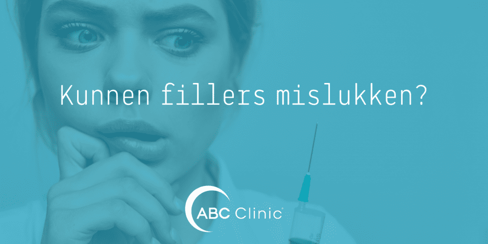 Fillers mislukt?