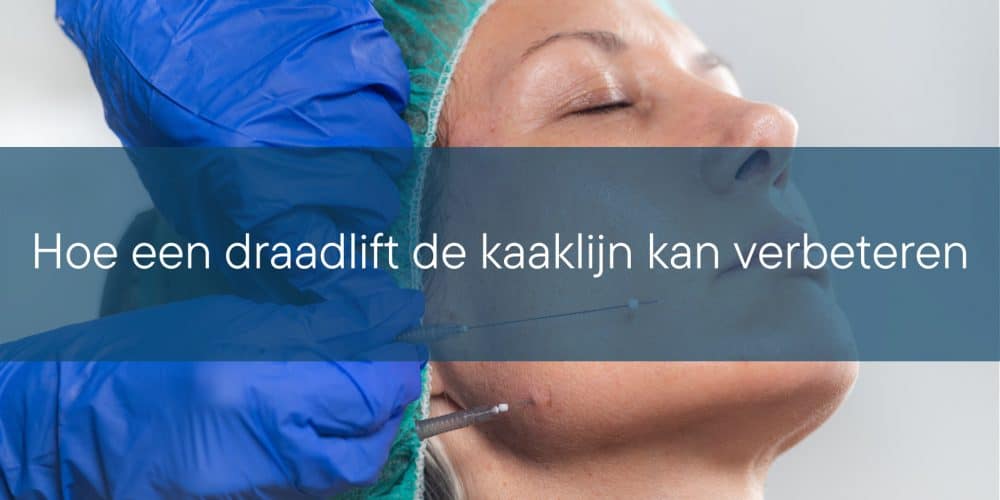 Hoe een draadlift de kaaklijn kan verbeteren