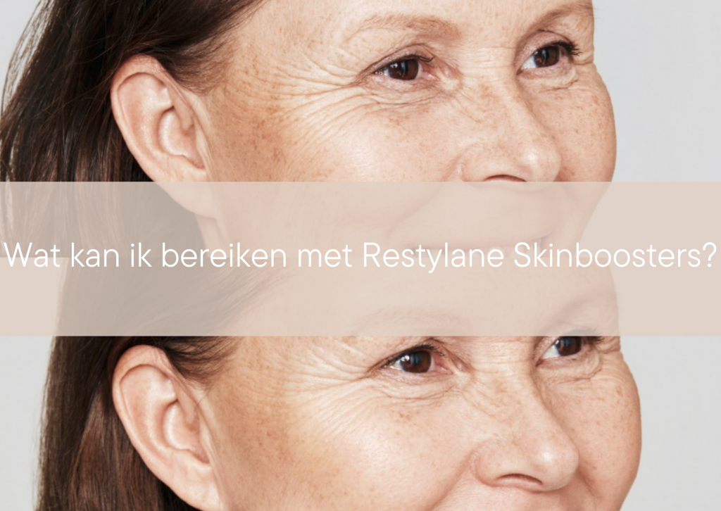 Wat kan ik bereiken met Restylane Skinboosters