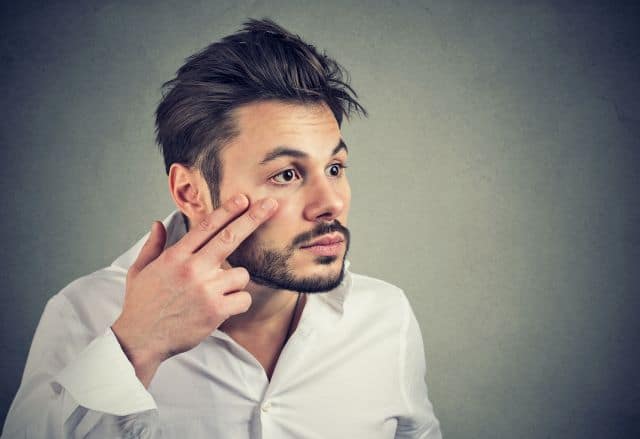 ooglidcorrectie, wallen, donkere kringen, brotox
